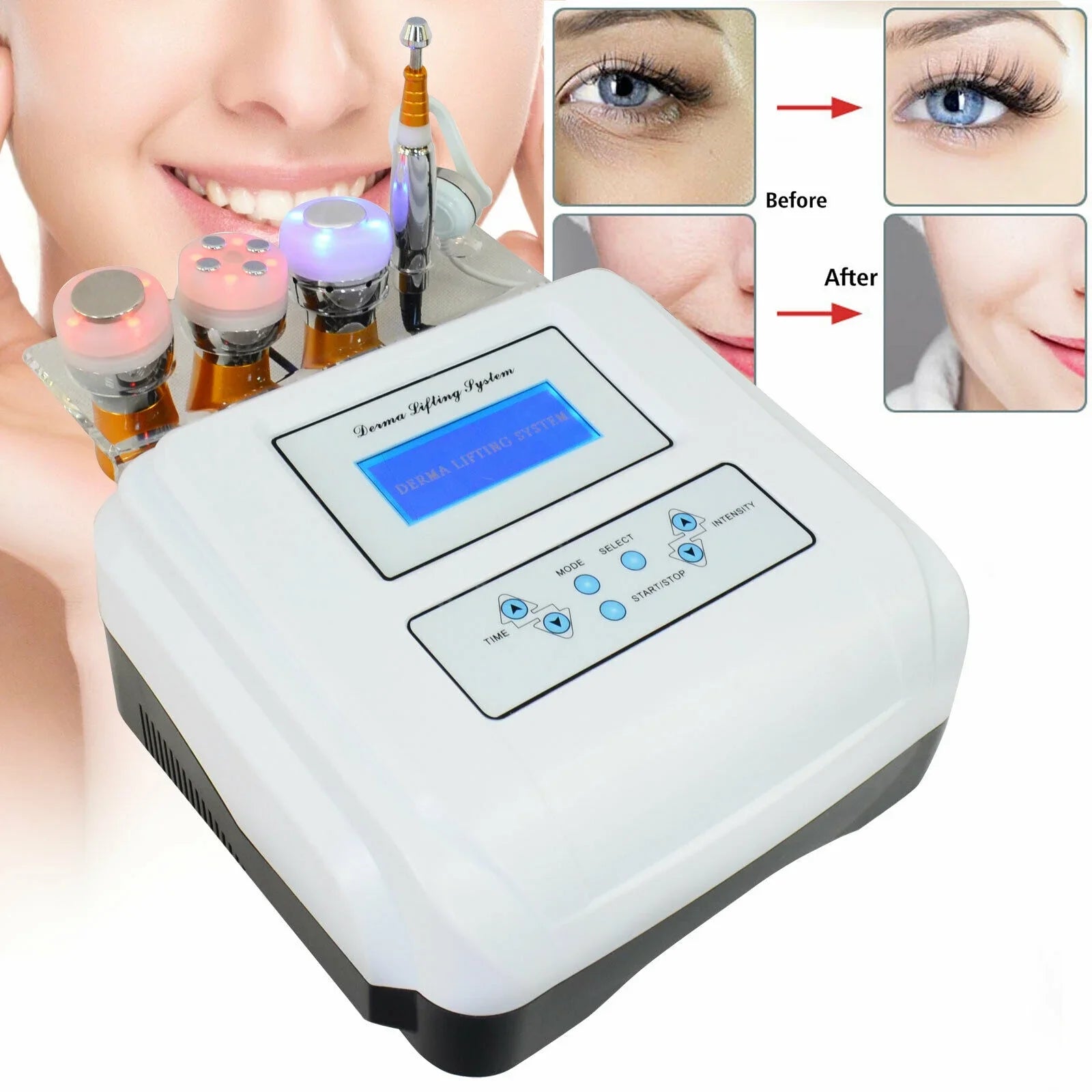 Cryo Electroporation No Needle Mesotherapy Skin Lift Wrinkle Removal Machine Spa