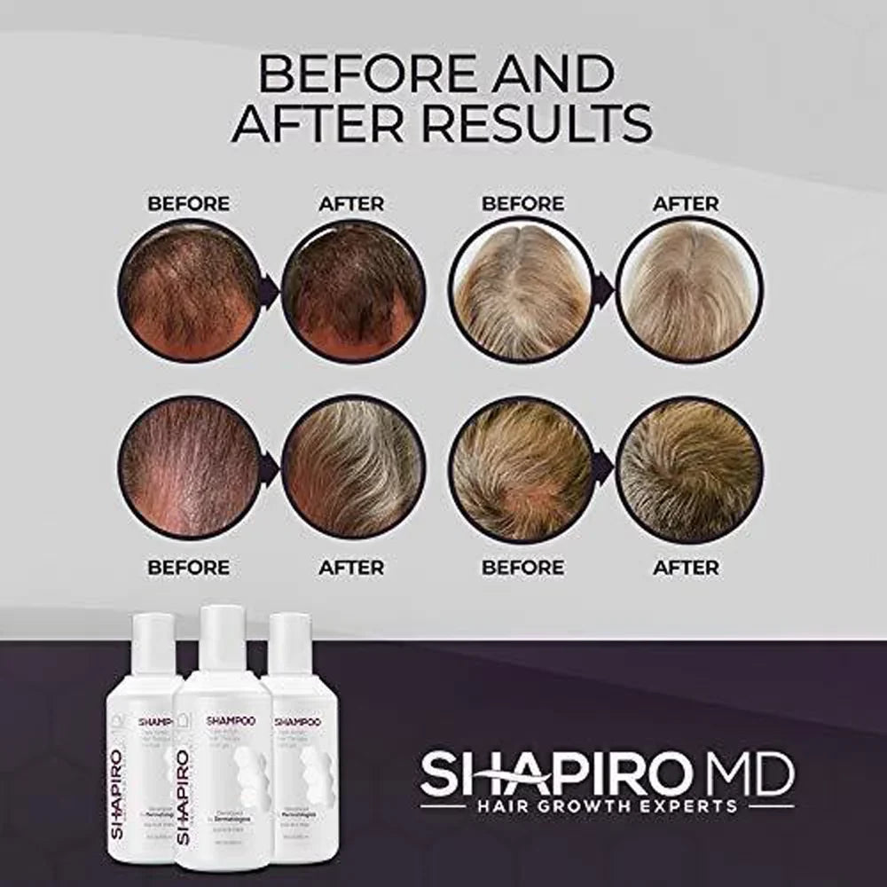 Shapiro  Hair Loss Shampoo,  Fighting Vegan Formula for Thinning Hair, 8 ounce (1 Month)